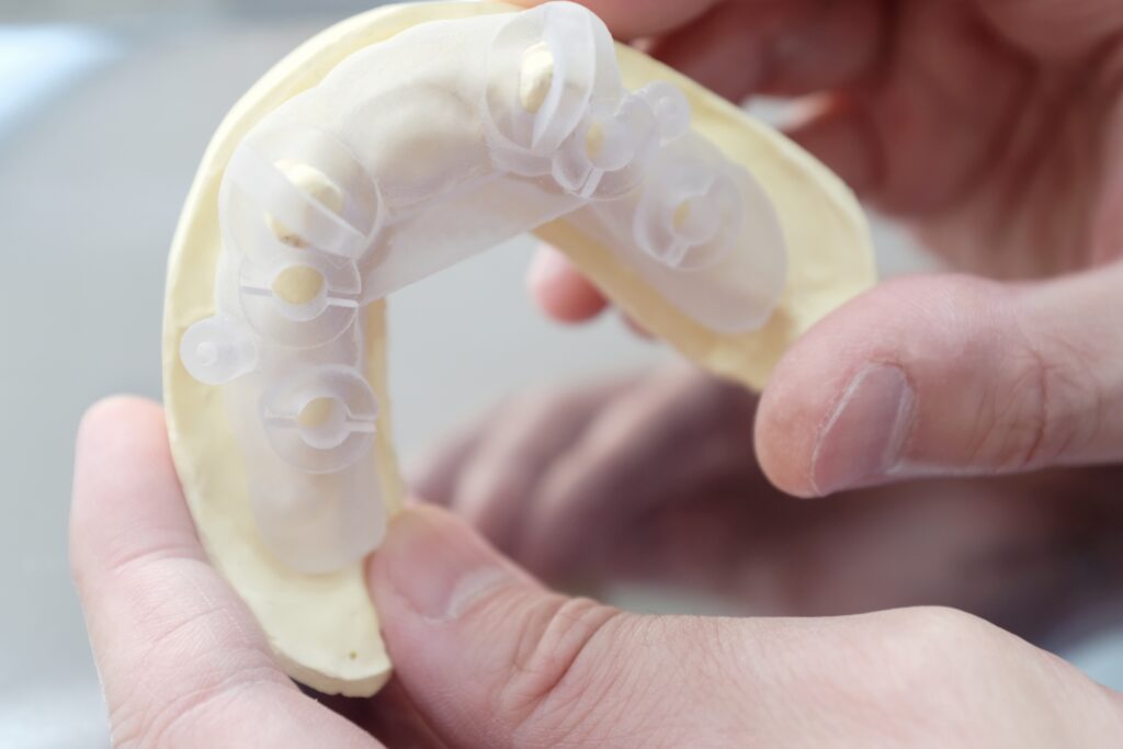 365디지털치과-둔산동네비게이션임플란트-네비게이션 임플란트 3d 가이드 모델