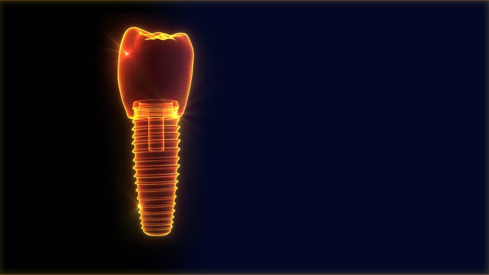 둔산동네비게이션임플란트-365디지털치과-디지털임플란트를 설명하는 이미지