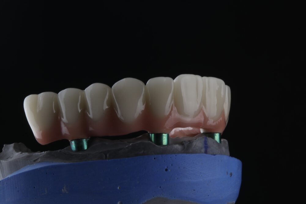 둔산동네비게이션임플란트