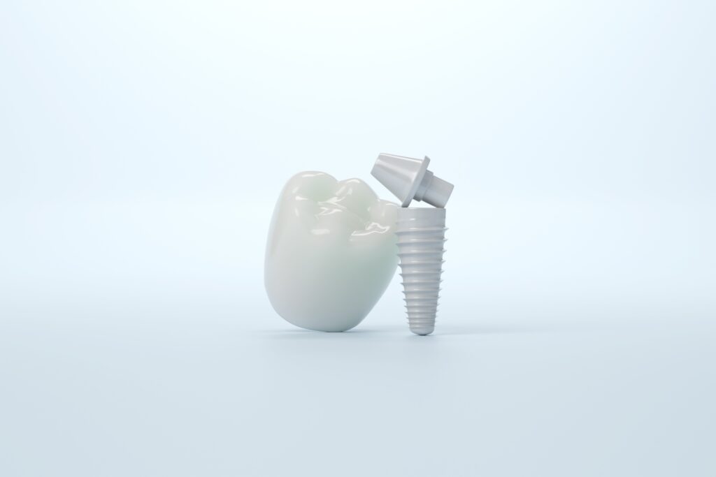 둔산동임플란트
